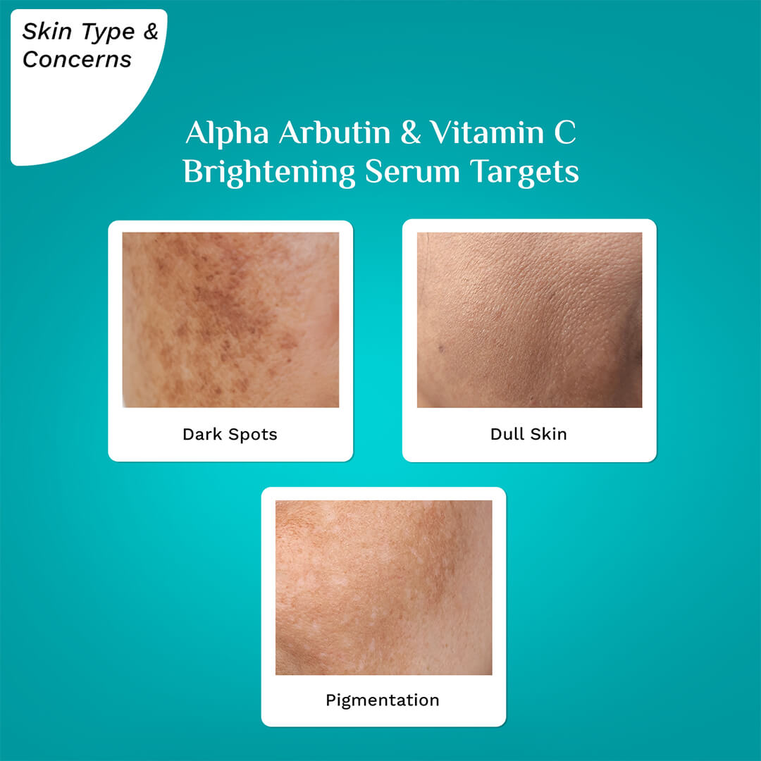 Alpha Arbutin & Vitamin C Brightening Serum (Copy)